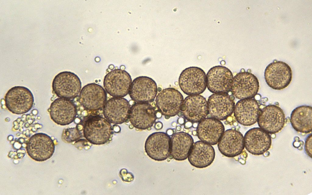 Physarum lateritium?